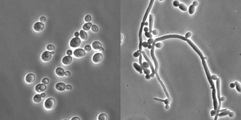 Дрожжеподобные грибы candida. Дрожжеподобные грибы: псевдомицелий. Candida albicans под микроскопом. Грибок кандида под микроскопом.