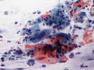 féreghajtó féregtelenítés kriptosporid oociszták és giardia ciszták