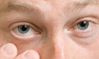 Nem csak a szemünk „tikkelhet”: egy titokzatos tünetcsoport nyomában