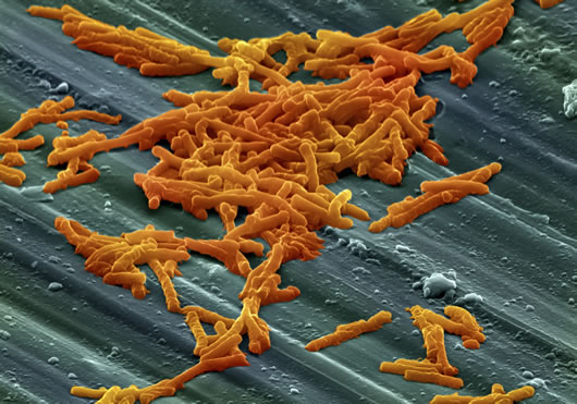 A Clostridium difficile baktérium