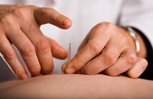 Akupunktúra a magas vérnyomás kezelésében, Így csökkenthető gyorsan a vérnyomás - HáziPatika