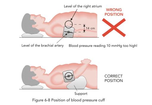 vérnyomás mérése melyik karon húsleves magas vérnyomás ellen