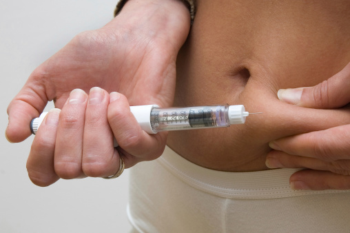 Az inzulinpumpa-kezelésről és felírhatóságáról