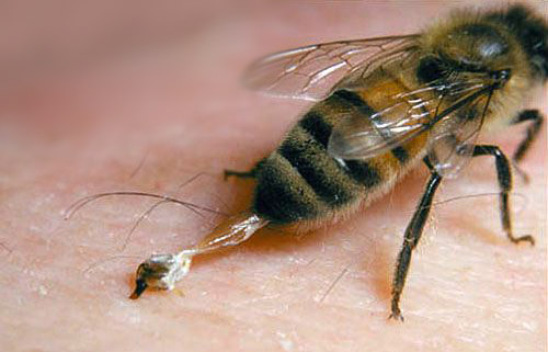 Méh- és darázsméreg allergia - tünetek és teendők