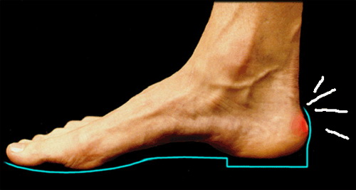 idősek közös kezelése a bal láb boka sérülése