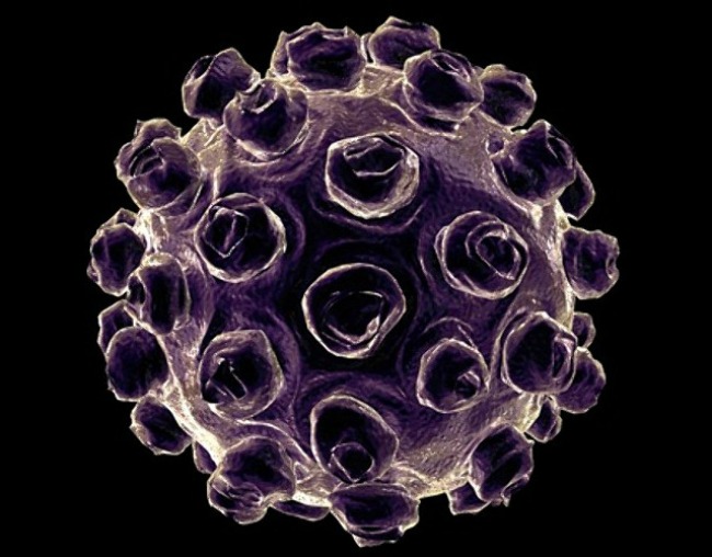 A kanyaróvírus modellje (Fotó: ipon.hu)