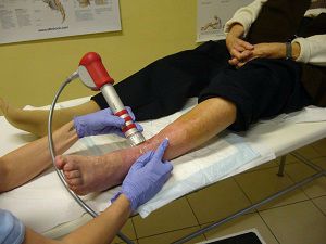 melyik orvost visszerekkel kell alkalmazni lábakon égő visszerek kezelése