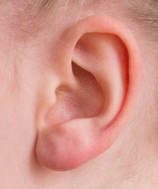 Zaj a fülekben - Diagnostics