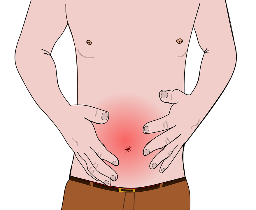 A Crohn-betegség és tünetei