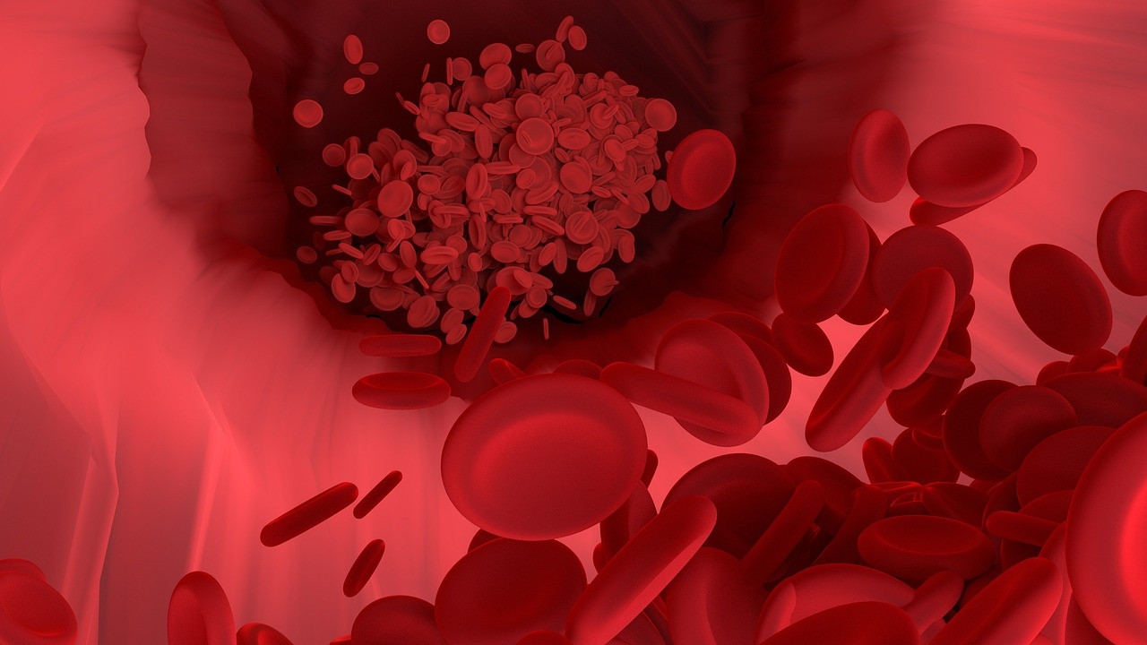 Vészes vérszegénység (anémia) tünetei és kezelése - HáziPatika