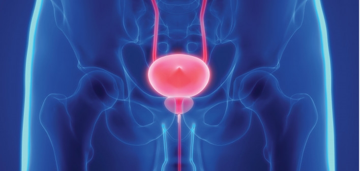 a prostatitis nem sürgeti a vizeletet prostatitis mri radiographics