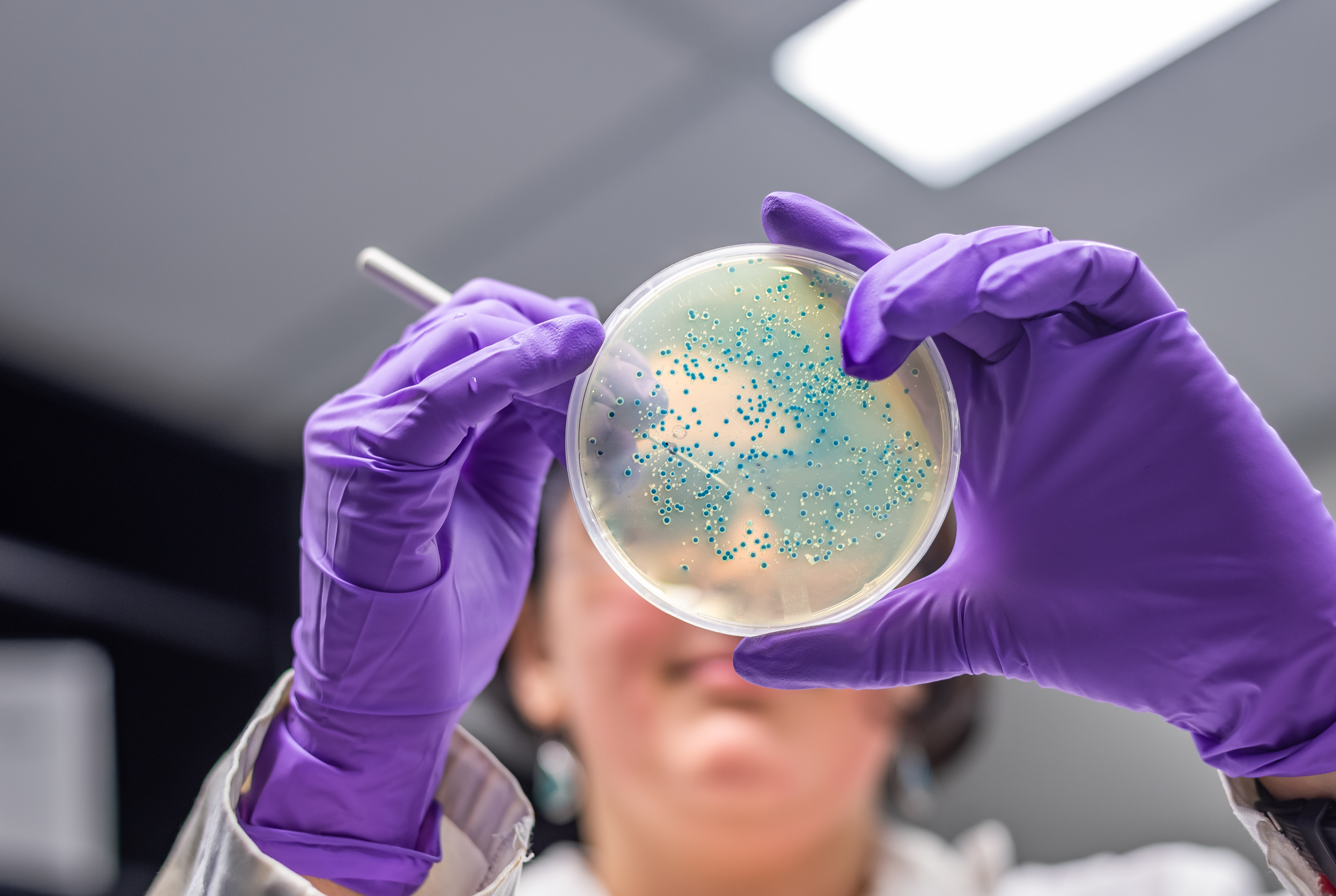 A mikrobiótát jótékony baktériumok, vírusok, gombák és egyéb mikroszkopikus élőlények alkotják. (Fotó: Envato Elements)